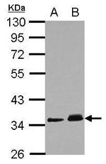 PPM1J Antibody in Western Blot (WB)