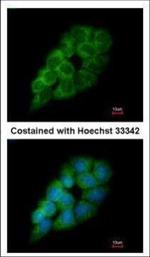 DARS Polyclonal Antibody