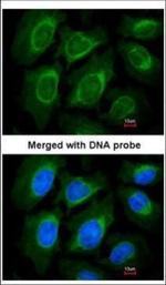 NOV Polyclonal Antibody