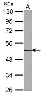 ZNF323 Antibody in Western Blot (WB)