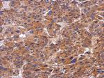 SNX9 Polyclonal Antibody