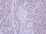 ZMYND11 Antibody in Immunohistochemistry (Paraffin) (IHC (P))
