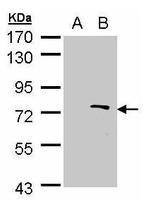 ZMYND11 Antibody in Western Blot (WB)