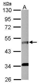 IL5RA Polyclonal Antibody