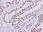 HYAL1 Antibody in Immunohistochemistry (Paraffin) (IHC (P))