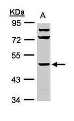 HYAL1 Antibody in Western Blot (WB)
