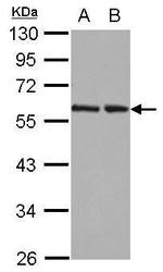 RAD23B Antibody in Western Blot (WB)