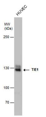 TIE1 Antibody in Western Blot (WB)