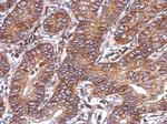 ACVR1C Polyclonal Antibody