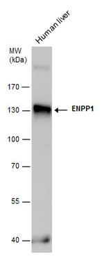 ENPP1 Polyclonal Antibody