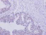 ZNF45 Antibody in Immunohistochemistry (Paraffin) (IHC (P))