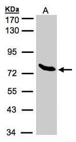 ZNF45 Antibody in Western Blot (WB)