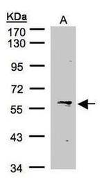 IFIT1 Antibody in Western Blot (WB)