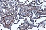 Vitronectin Polyclonal Antibody