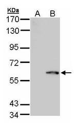 FPGS Antibody in Western Blot (WB)