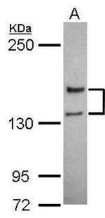 NMDAR2A Antibody in Western Blot (WB)