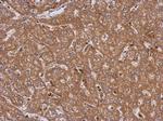 LRRN2 Polyclonal Antibody