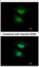 NAB2 Polyclonal Antibody