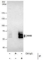 NAB2 Antibody in Immunoprecipitation (IP)