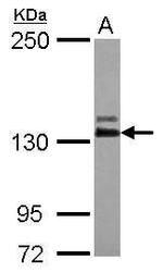 Abl2 Polyclonal Antibody