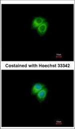 Adenylate Kinase 7 Polyclonal Antibody