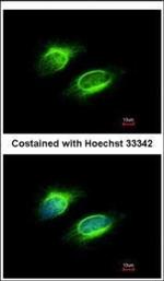PAPSS1 Polyclonal Antibody