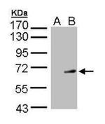 Synaptotagmin 1 Antibody in Western Blot (WB)