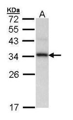 Cyclophilin E Antibody in Western Blot (WB)