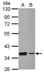 HSF2BP Antibody in Western Blot (WB)