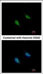 RFC3 Polyclonal Antibody