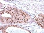 RFC3 Antibody in Immunohistochemistry (Paraffin) (IHC (P))