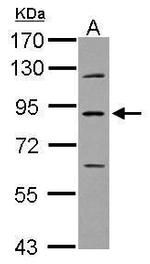 PLA2G6 Polyclonal Antibody