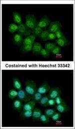 PRMT2 Polyclonal Antibody