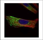 Cytokeratin 17 Antibody in Immunocytochemistry (ICC/IF)