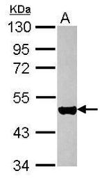 Cytokeratin 17 Antibody in Western Blot (WB)