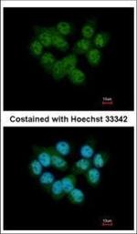 SEPHS2 Polyclonal Antibody