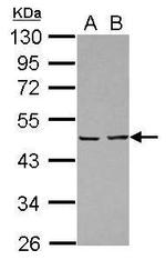 EBP1 Polyclonal Antibody