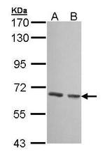 GCKR Polyclonal Antibody