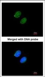 PSMA5 Polyclonal Antibody