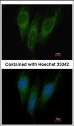 DNAJC1 Polyclonal Antibody