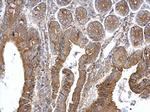 TPK1 Polyclonal Antibody