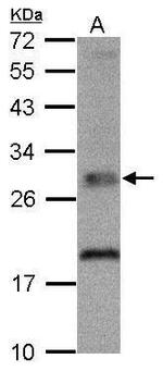 TPK1 Antibody in Western Blot (WB)