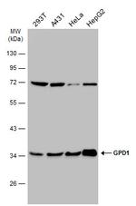 GPD1 Antibody in Western Blot (WB)