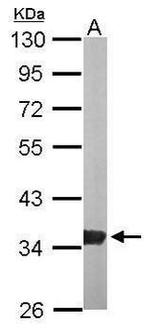 GPD1 Antibody in Western Blot (WB)
