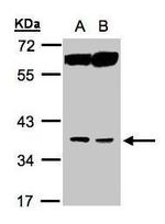 ACOT8 Polyclonal Antibody