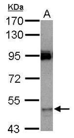 CYP3A7 Polyclonal Antibody