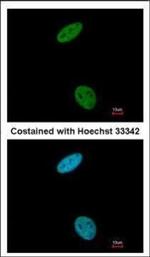 CDK6 Antibody in Immunocytochemistry (ICC/IF)