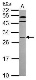 HOXC8 Antibody in Western Blot (WB)