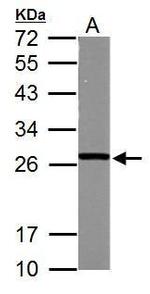GSTM5 Polyclonal Antibody
