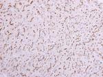 ST6GAL1 Polyclonal Antibody